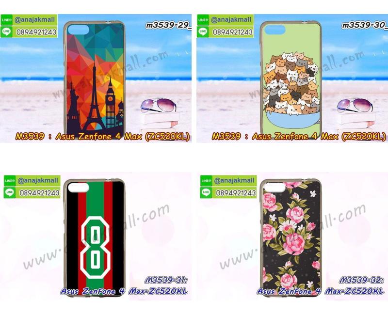 เคส ZenFone4 Max zc520kl,รับสกรีนเคสฝาพับasus zenfone4 max zc520kl,สกรีนเคสการ์ตูนasus zenfone4 max zc520kl,รับพิมพ์ลายเคส ZenFone4 Max zc520kl,เคสหนัง ZenFone4 Max zc520kl,เคสไดอารี่ ZenFone4 Max zc520kl,zenfone4 max กรอบประกบ,พิมเครชลายวันพีชพร้อมสายคล้องasus zenfone4 max zc520kl,asus zenfone4 max zc520kl กรอบยางแต่งคริสตัลสายคล้องมือ,พิมเครชการ์ตูนasus zenfone4 max zc520kl,พิมพ์เคสแข็งasus zenfone4 max zc520kl,เคสพิมพ์ลาย ZenFone4 Max zc520kl,เคสasus zenfone4 max zc520kl ลาย anime,กรอบโลหะลายการ์ตูนasus zenfone4 max zc520kl,สั่งสกรีนเคส ZenFone4 Max zc520kl,หนังasus zenfone4 max zc520kl โชว์เบอร์,พิมพ์asus zenfone4 max zc520kl ,พิมพ์เคส ZenFone4 Max zc520kl,เคสฝาพับ ZenFone4 Max zc520kl,เคสโรบอท ZenFone4 Max zc520kl,เคสซิลิโคนZenFone4 Max zc520kl,กรอบหนัง ZenFone4 Max zc520kl,asus zenfone4 max zc520kl ลายการ์ตูนวันพีช,เคสสกรีนลาย ZenFone4 Max zc520kl,เคสยาง ZenFone4 Max zc520kl onepiece,ยางนิ่มการ์ตูนasus zenfone4 max zc520kl,เคสซิลิโคนพิมพ์ลาย ZenFone4 Max zc520kl,สั่งทำการ์ตูนเคสasus zenfone4 max zc520kl,เกราะasus zenfone4 max zc520kl,เคสแข็งพิมพ์ลาย ZenFone4 Max zc520kl,asus zenfone4 max zc520kl กรอบประกบ,กรอบasus zenfone4 max zc520kl ระบายความร้อน,zenfone4 max กรอบยางนิ่มวันพีช,ยางกันกระแทกzenfone4 max,เคสยางคริสตัลติดแหวน ZenFone4 Max zc520kl,เคสบั้มเปอร์ ZenFone4 Max zc520kl,เคสประกอบ ZenFone4 Max zc520kl,เกราะasus zenfone4 max zc520kl ฝาพับ,ซองหนัง ZenFone4 Max zc520kl,ฝาครอบหลังประกบหัวท้ายasus zenfone4 max zc520kl,เคสลาย 3D ZenFone4 Max zc520kl,เกราะอลูมิเนียมเงากระจกasus zenfone4 max zc520kl,ซองหนังasus zenfone4 max zc520kl,เคสเปิดปิดasus zenfone4 max zc520kl,เคสหนังการ์ตูนasus zenfone4 max zc520kl,เคสอลูมิเนียมasus zenfone4 max zc520kl,เคสกันกระแทก ZenFone4 Max zc520kl,เคสโทรศัพท์ ZenFone4 Max zc520kl,เคสสะพายasus zenfone4 max zc520kl,กรอบหนังฝาพับasus zenfone4 max zc520kl,เคสกระจกasus zenfone4 max zc520kl,สกรีนเคสวันพีชasus zenfone4 max zc520kl,หนังโทรศัพท์ ZenFone4 Max zc520kl,เคสหนังฝาพับ ZenFone4 Max zc520kl,เคสนิ่มสกรีนลาย ZenFone4 Max zc520kl,เคสแข็ง ZenFone4 Max zc520kl,เครชzenfone4 max ประกบหน้าหลัง,กรอบ ZenFone4 Max zc520kl,เคสasus zenfone4 max zc520kl ระบายความร้อน,กรอบประกบหน้าหลังasus zenfone4 max zc520kl,เคสยางสายคล้องคอasus zenfone4 max zc520kl,ซองฝาพับasus zenfone4 max zc520kl,สกรีนดาราเกาหลีasus zenfone4 max zc520kl,พร้อมส่งเครชพิมพ์ลายasus zenfone4 max zc520kl,ซองหนังลายการ์ตูน ZenFone4 Max zc520kl,สกรีนasus zenfone4 max zc520kl,asus zenfone4 max zc520kl เครชประกบหัวท้าย,กรอบประกบหน้าหลัง ZenFone4 Max zc520kl,เคสฝาปิดการ์ตูน ZenFone4 Max zc520kl,โชว์เบอร์asus zenfone4 max zc520kl ลายการ์ตูน,เคสประกบ ZenFone4 Max zc520kl,ยางนิ่มตัวการ์ตูนasus zenfone4 max zc520kl,กรอบคริสตัลยาง ZenFone4 Max zc520kl,กรอบโทรศัพท์ ZenFone4 Max zc520kl,เคสสกรีน ZenFone4 Max zc520kl,เคสโทรศัพท์ ZenFone4 Max zc520kl,หนังฝาพับใส่เงินใส่บัตรasus zenfone4 max zc520kl,เคสประกบ ZenFone4 Max zc520kl,ฝาพับกระจกเงาasus zenfone4 max zc520kl,กรอบasus zenfone4 max zc520kl,เคสประกบปั้มเปอร์ ZenFone4 Max zc520kl,กรอบบัมเปอร์เคสasus zenfone4 max zc520kl,กรอบนิ่มติดแหวนasus zenfone4 max zc520kl,เกราะนิ่มzenfone4 max กันกระแทก,ซิลิโคนตัวการ์ตูนasus zenfone4 max zc520kl,เคส 2 ชั้น กันกระแทก ZenFone4 Max zc520kl,เคสแต่งคริสตัลยางนิ่มasus zenfone4 max zc520kl,ฝาหลังสกรีนasus zenfone4 max zc520kl,เคสโรบอทกันกระแทก ZenFone4 Max zc520kl